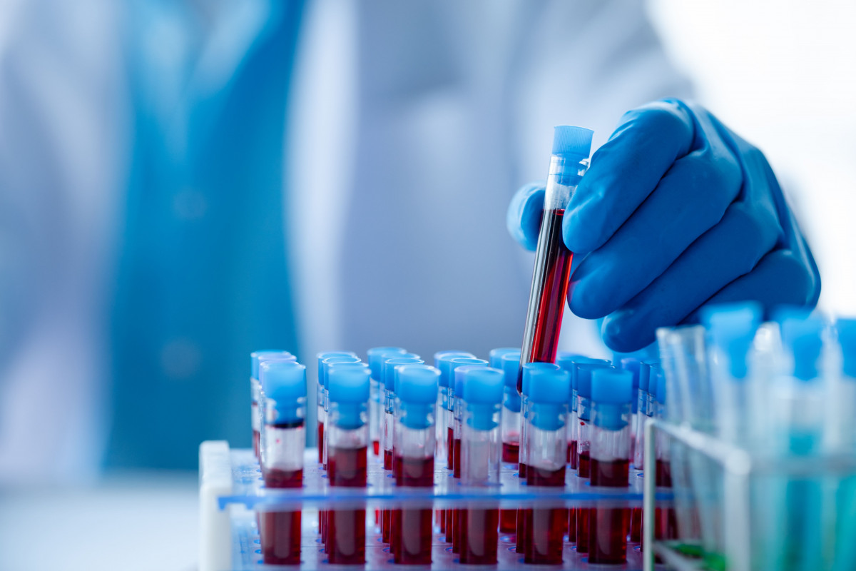 Estradiol hormone analysis