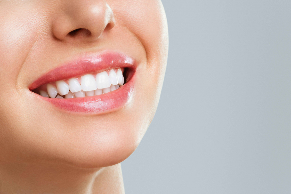 German flash laser teeth whitening